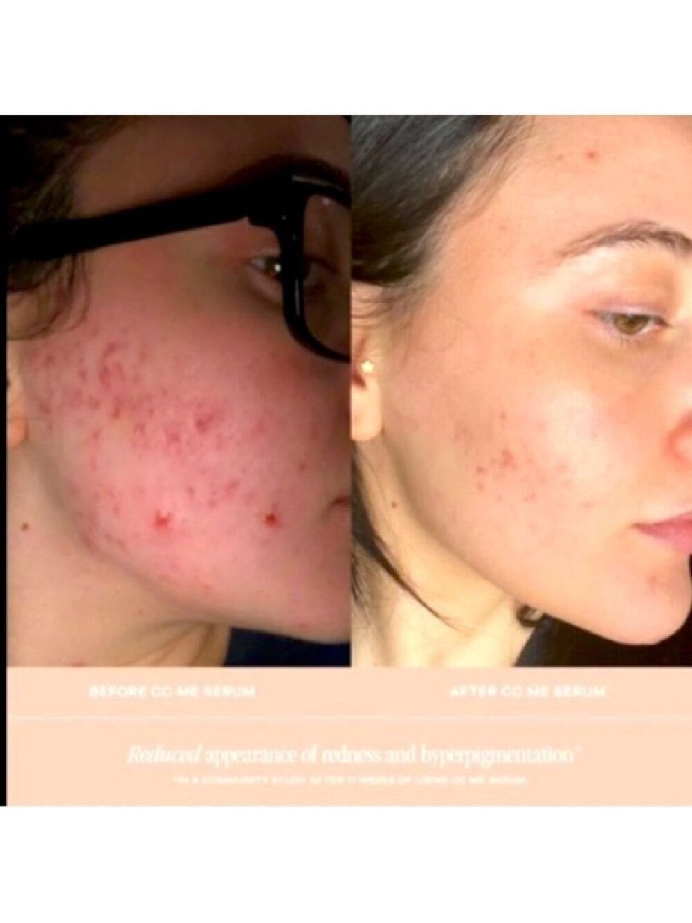 Summer Fridays Vitamin C Serum Antioxidant Niacinamide Collagen - Picture 3 of 9